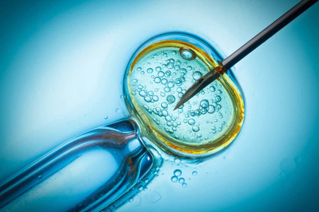 IVF in Europe vs the US: What Americans Need to Know in 2026